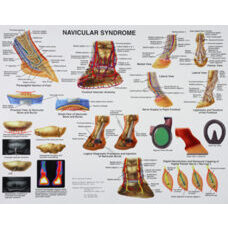 Navicular syndrome